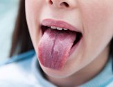Лечение ранки на языке: медикаментозное и нетрадиционное