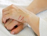 Распространенные причины плохо заживающих ран на коже