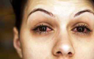 Химический ожог глаза: симптомы, первая помощь и последующее лечение