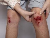 Рана на ноге долго не заживает: способы ускорения восстановления