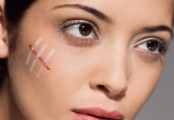 Как избавиться от шрамов на лице: обзор эффективных методов