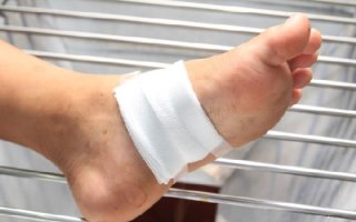 Инфицированная рана стопы и голени код по МБК 10: как избежать инфекции