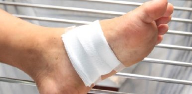Инфицированная рана стопы и голени код по МБК 10: как избежать инфекции