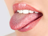 Особенности лечения и оказания первой помощи при ожоге языка