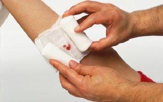 Чем лечить мокнущую рану и почему она не заживает