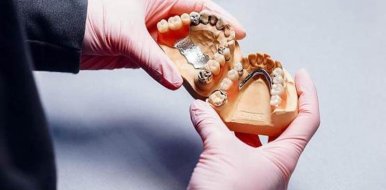Имплантация жевательных зубов на верхней челюсти