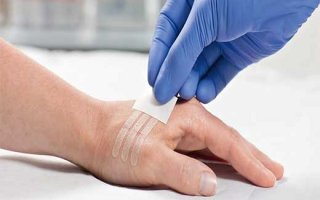 Как правильно использовать стягивающие пластыри для лечения ран