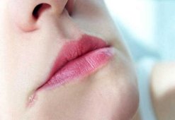 Причины появления и способы лечения ранок в уголках рта