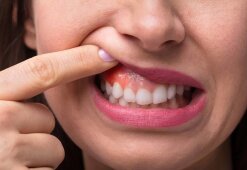Что делать, если около зуба воспалилась десна:  причины  и  меры профилактики