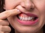 Что делать, если около зуба воспалилась десна:  причины  и  меры профилактики