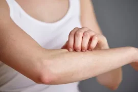 Почему чешется ожог и как уменьшить зуд